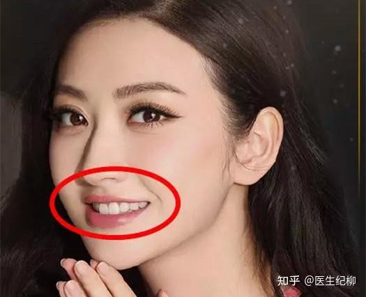 这里我只说镜头下的景甜的嘴,还是非常好看的,唇峰