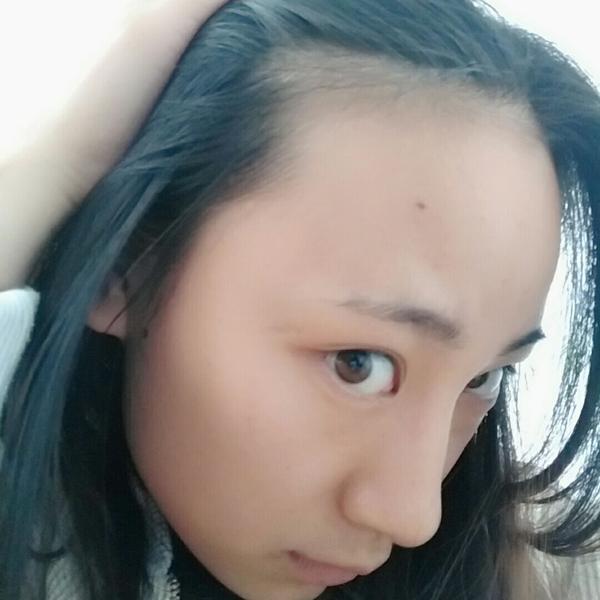 发际线高的女生能留中分么?
