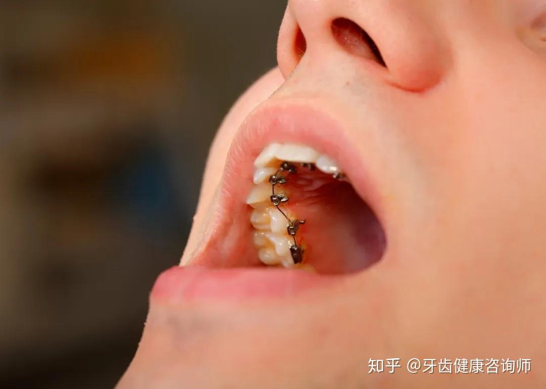 调香师证的报考费用_报考证费用调香师可以退吗_调香师要考证吗