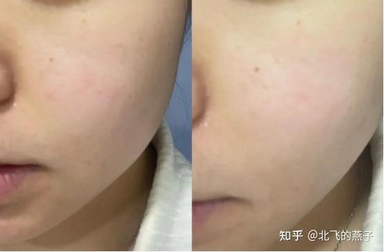 为啥空姐通宵飞大夜,脸照样是透亮的? - 知乎