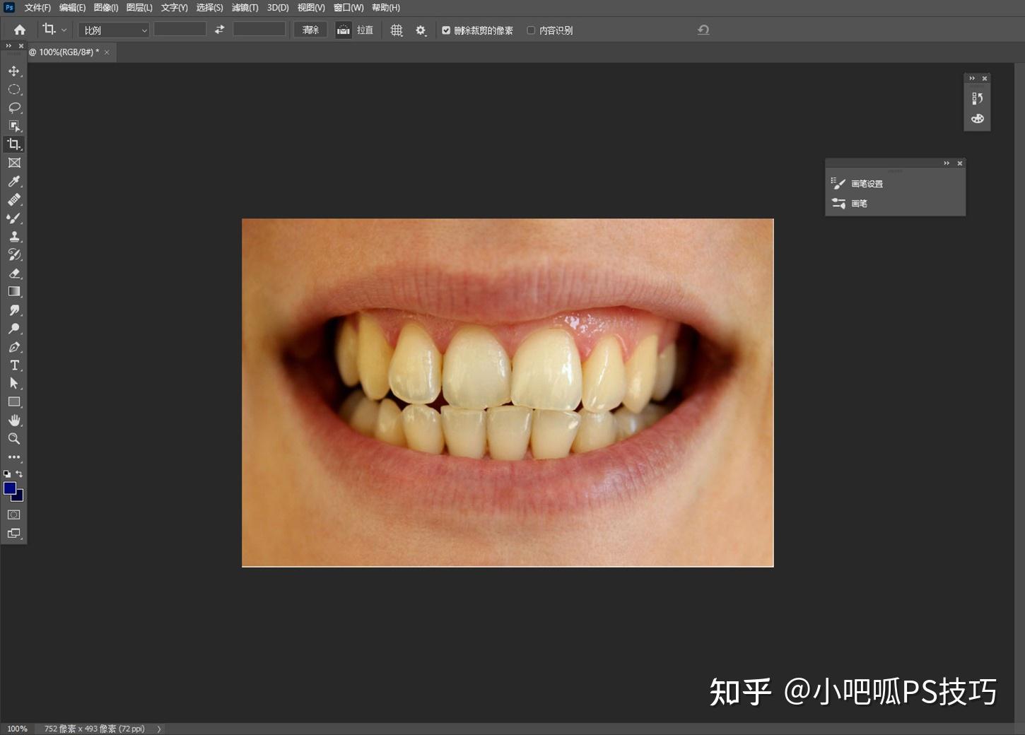 一般性黄牙做过冷光牙齿美白的对比图-赵振的博客-KQ88口腔博客