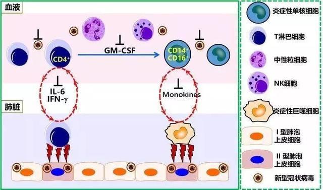 双歧杆菌三联活菌制剂可抑制促炎细胞因子分泌或可预防新冠肺炎炎症