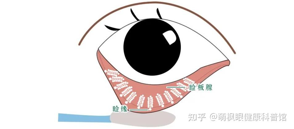 为什么睑板腺功能障碍会引发干眼？ - 知乎