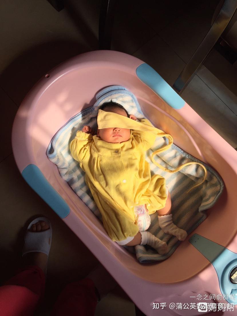 新生儿宝宝有黄疸晒太阳可以祛黄吗