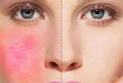 知乎上关于敏感肌问题的全部问答 知乎