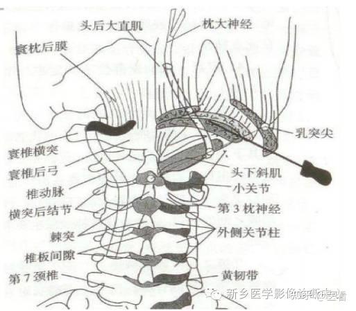 四組肌肉雖然短小,卻發育良好,由於其位置深在,淺層解剖很難觀察其