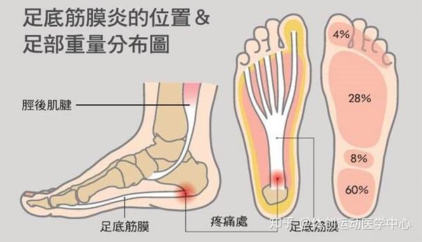 针对足底筋膜炎 别忘了 趾短屈肌 知乎