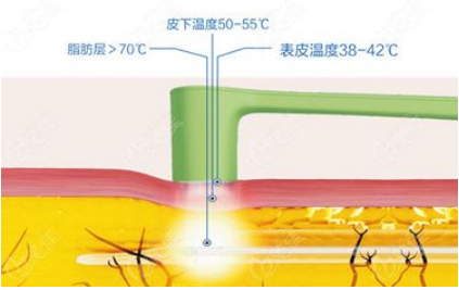 维密脂雕和黄金微雕图片