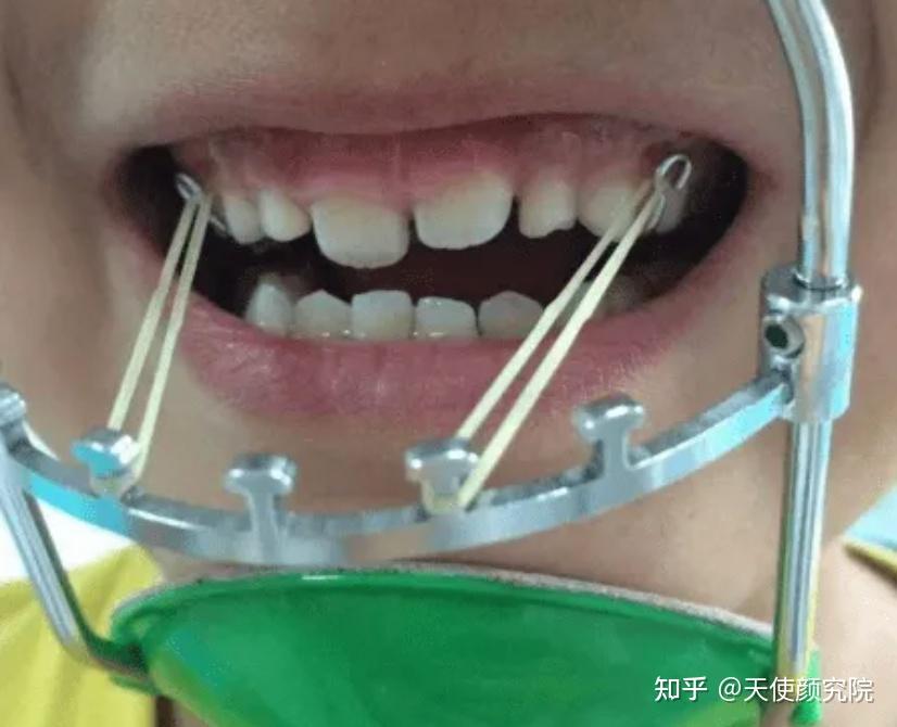 郑秀妍这段太蛊了吧!芒果台怎么能删了不播??!(郑秀妍签约英皇)