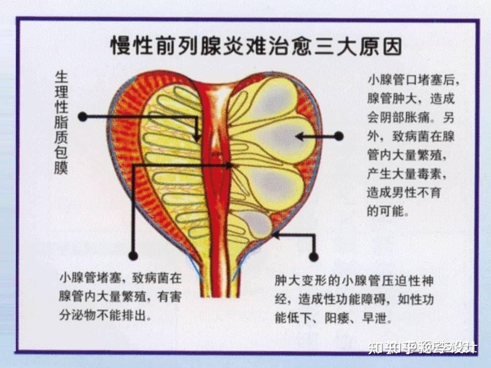 前列腺液怎么排出来图片