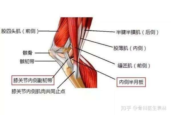 前十字韧带,位于膝关节内,连接股骨与胫骨(起于股骨髁间窝外后部,向前