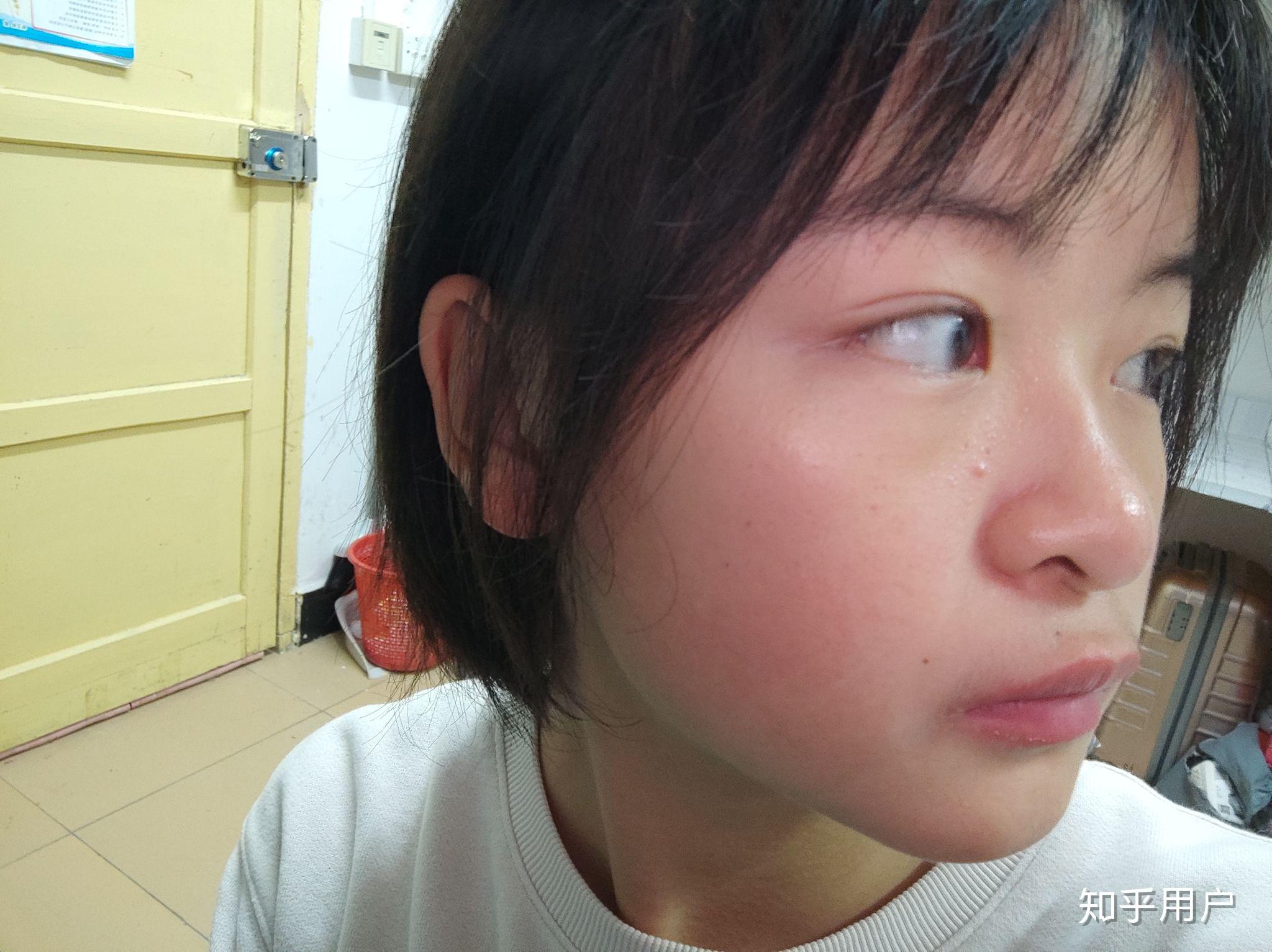 没有鼻梁鼻子塌的人是什么体验