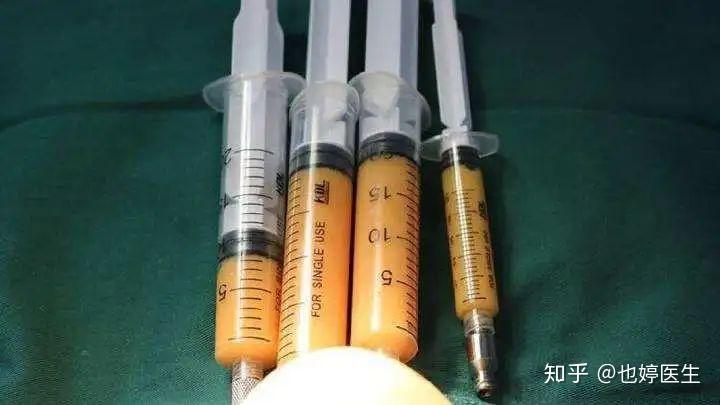 用高濃度生長因子,注射全臉,刺激細胞再生;具體的可以參考這篇文章