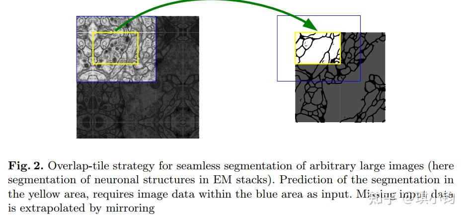 U Net ：convolutional Networks For Biomedical Image Segmentation 论文详解 知乎