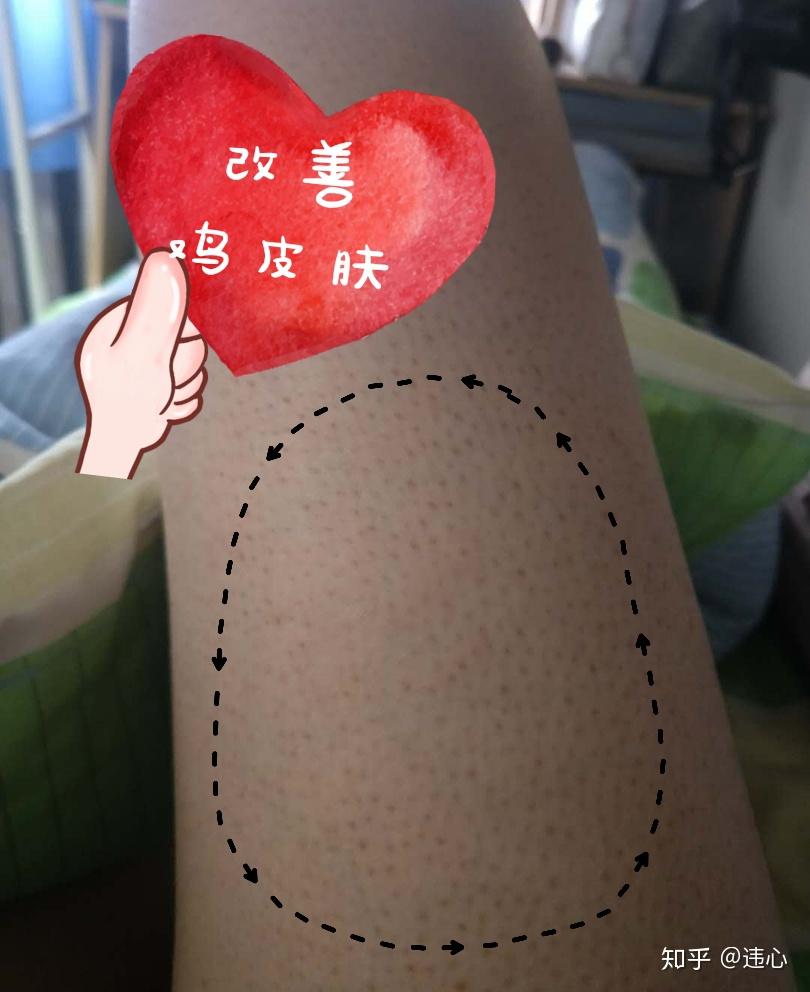 男朋友会在意鸡皮肤(男朋友会嫌弃鸡皮肤吗)