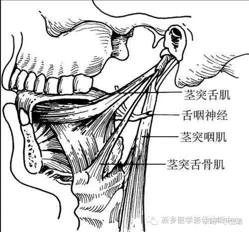 因此,茎突发育异常或舌骨韧带骨化,导致茎突过长或生长方位,形态异常