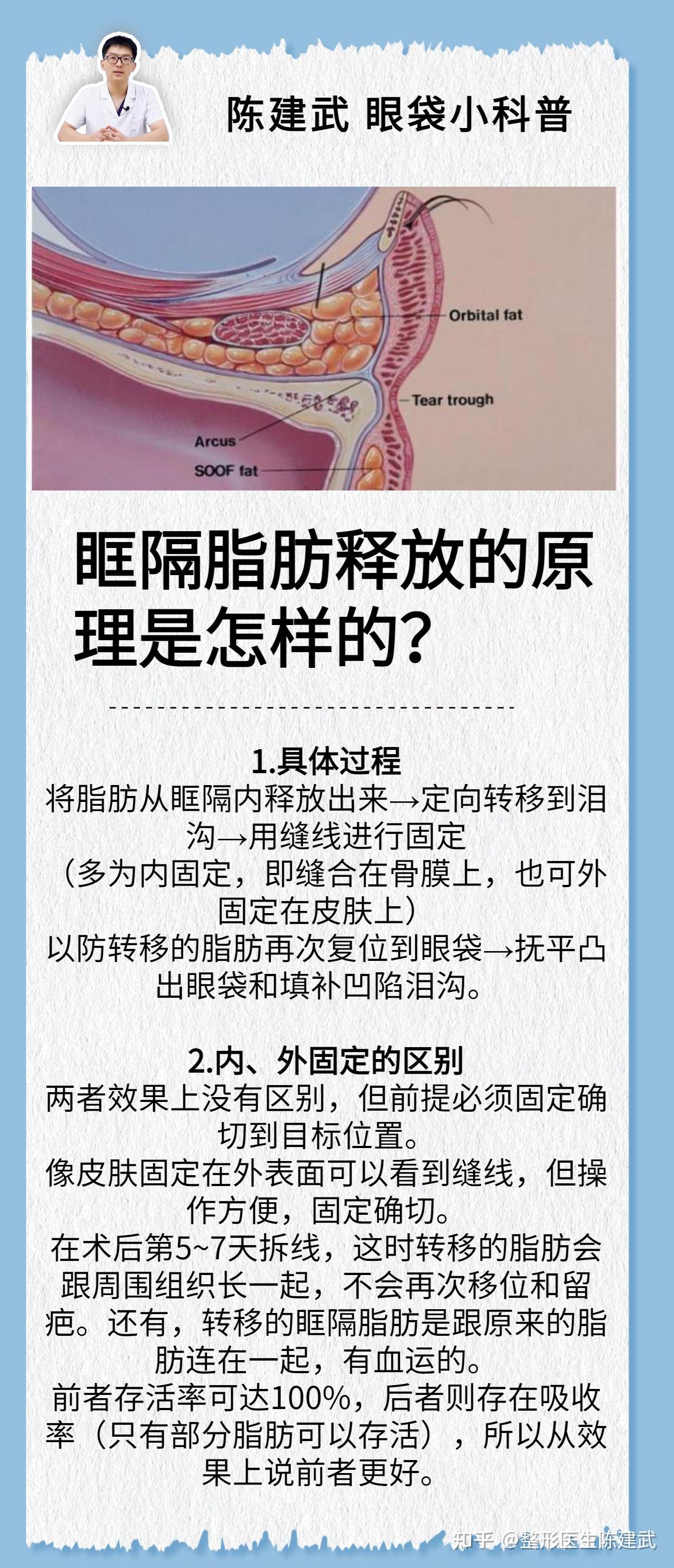 祛眼袋、祛泪沟|眶隔脂肪释放的原理是怎样的？ - 知乎