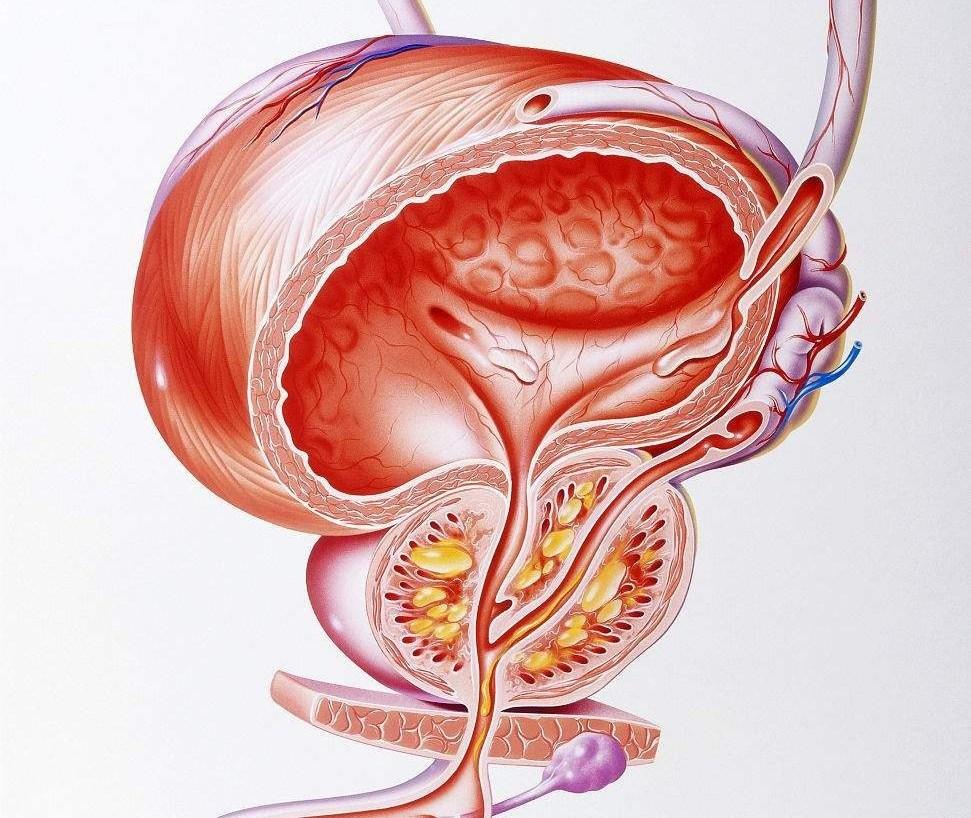 什麼是慢性前列腺炎
