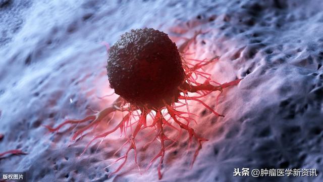 患者怎样知道自己的肿瘤是良性还是恶性恶性肿瘤真的能根治吗