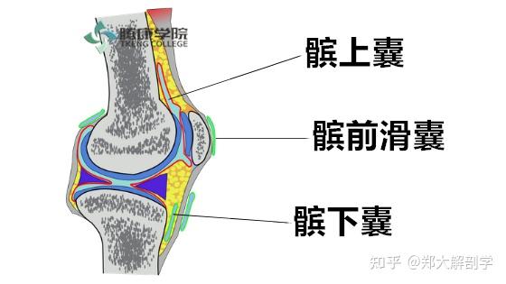 髌前滑囊炎 