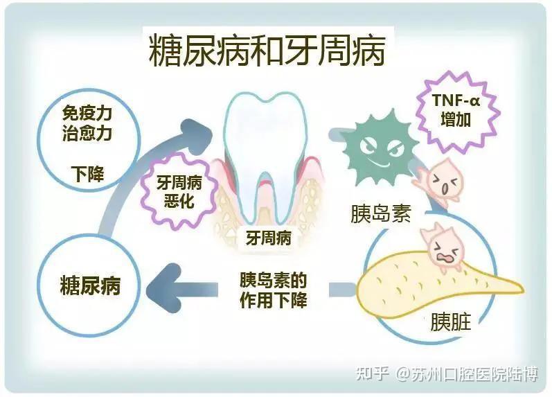 糖尿病人最容易发生的5个牙齿问题，知道这5招还不晚！ - 知乎