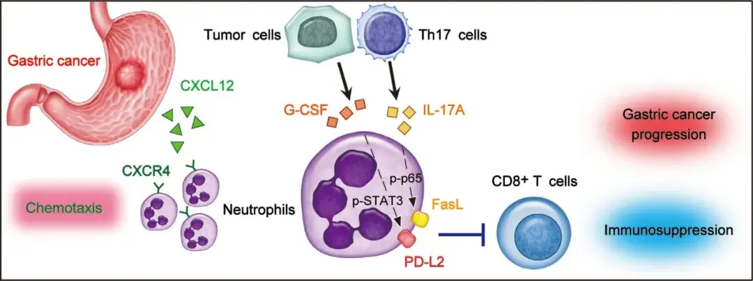 advsciyuanzhuang团队指出人胃癌中新型免疫抑制中性粒
