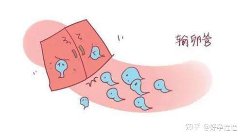 输卵管硬化症的患者故事：分享经历，传递勇气 (输卵管硬化症能治好吗)