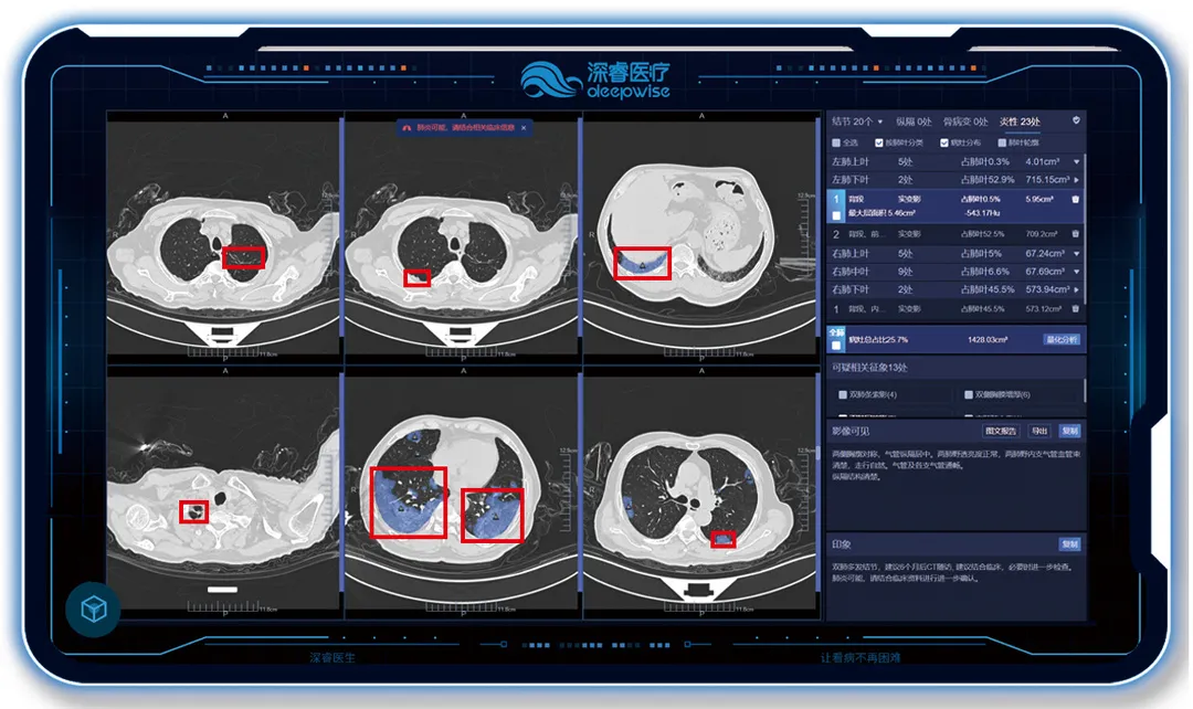 深睿医疗联合天津市海河医院最新科研成果被国际医学影像领域期刊