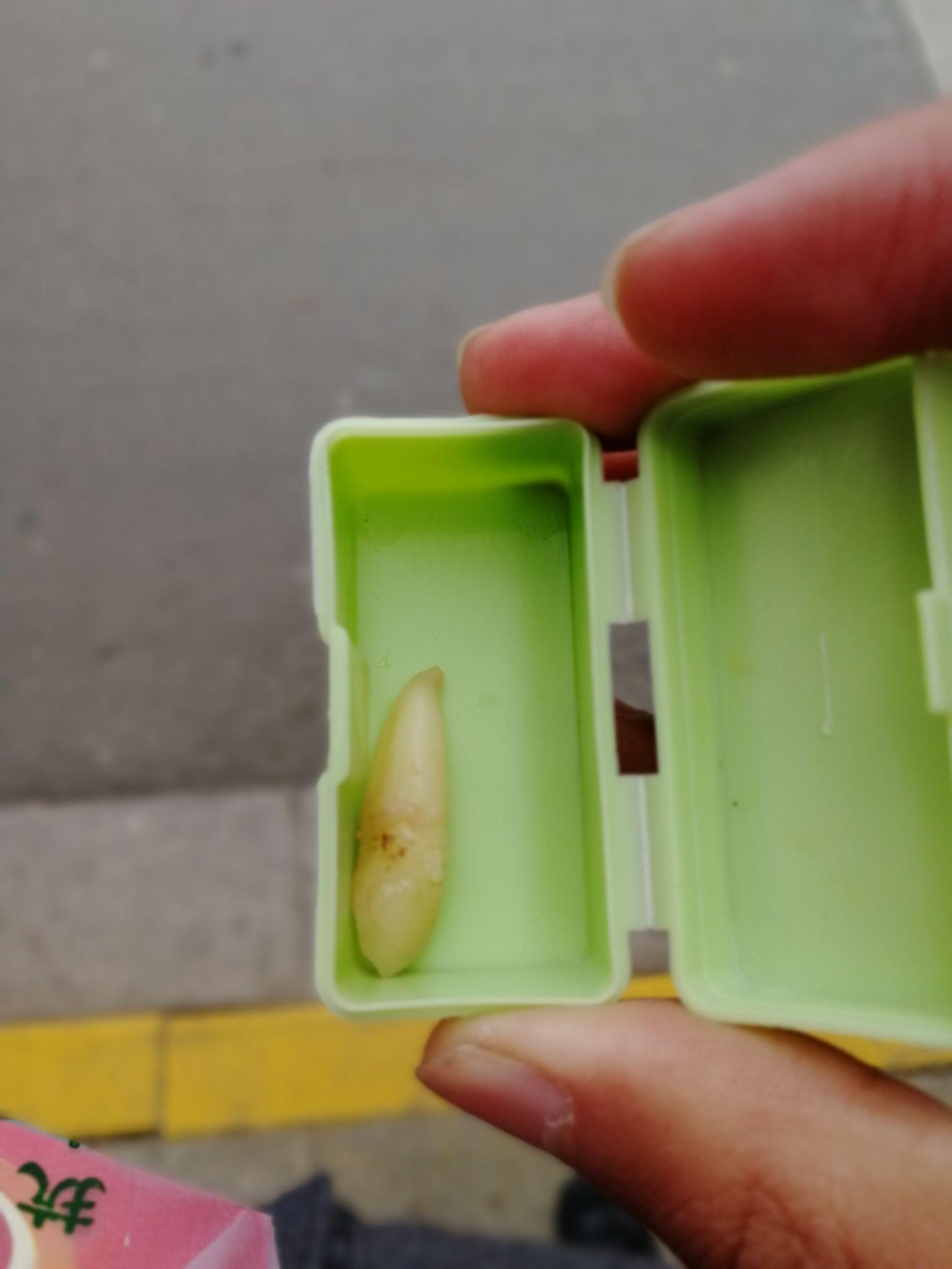 拔牙后的那窟窿会怎样,会长愈合吗?