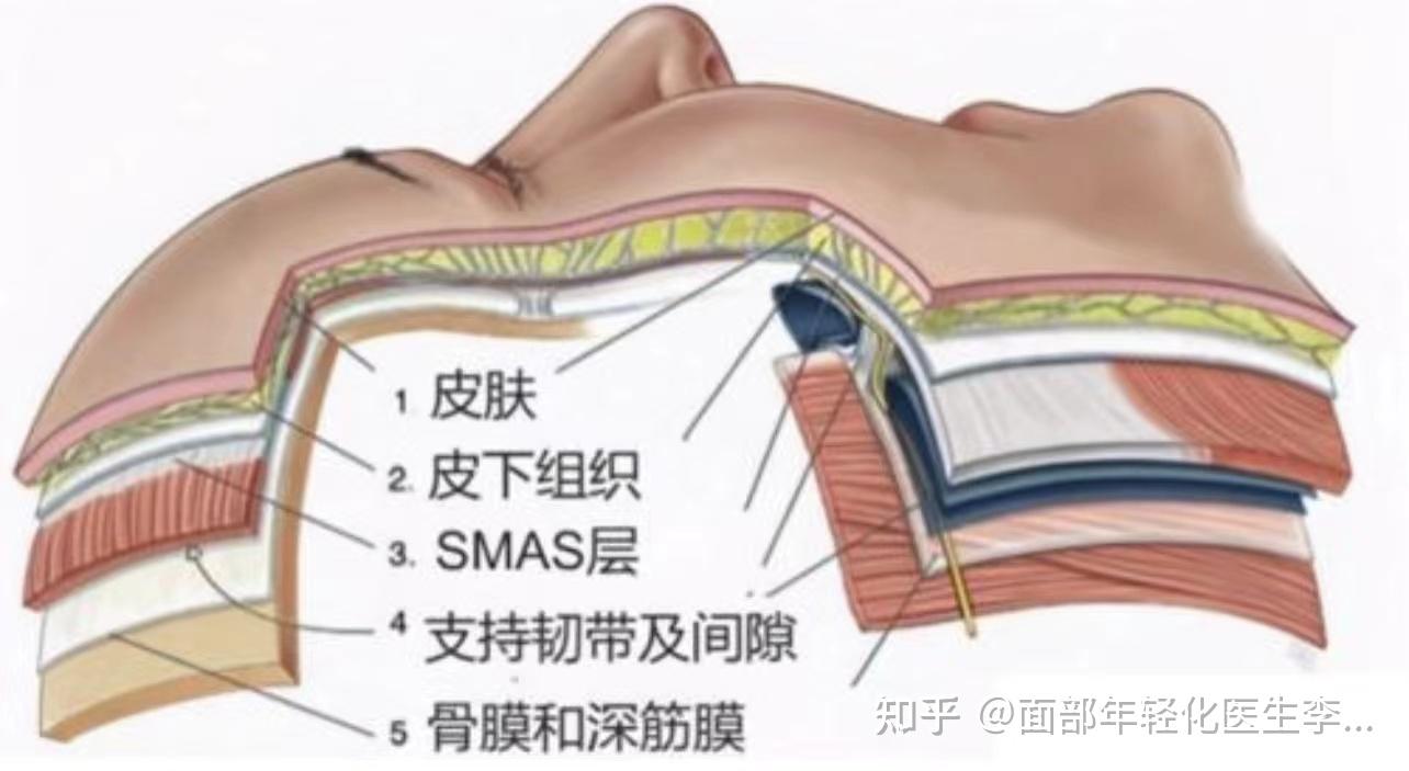 面部软组织是同步下垂的吗?