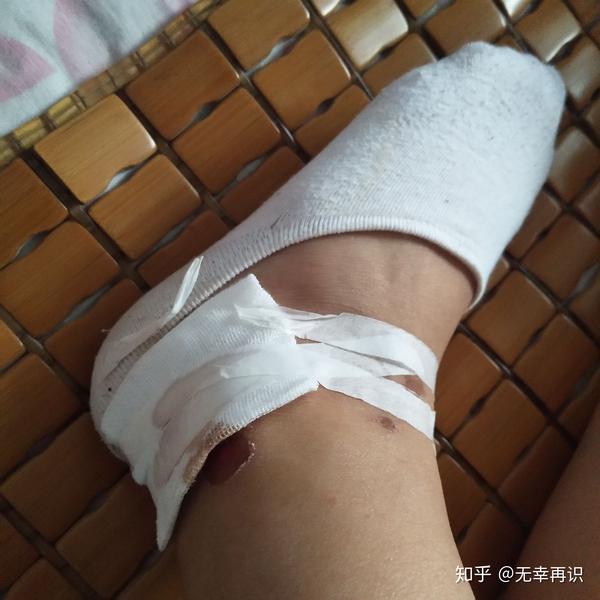 关于骑着车摔下来