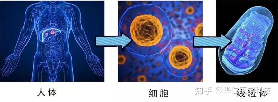 潜行的健康“杀手”——代谢综合征 - 知乎