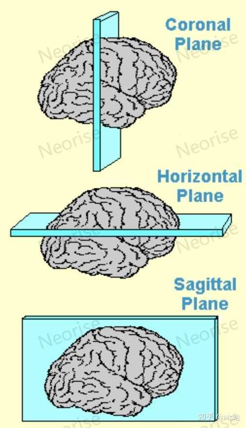 组织学切片与染色指南·脑组织篇 - 知乎