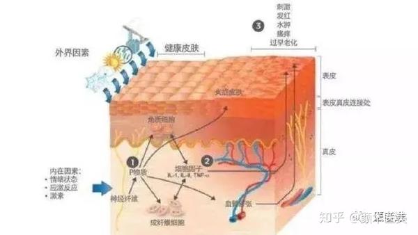 去角质后 脸为什么会又红又热 知乎