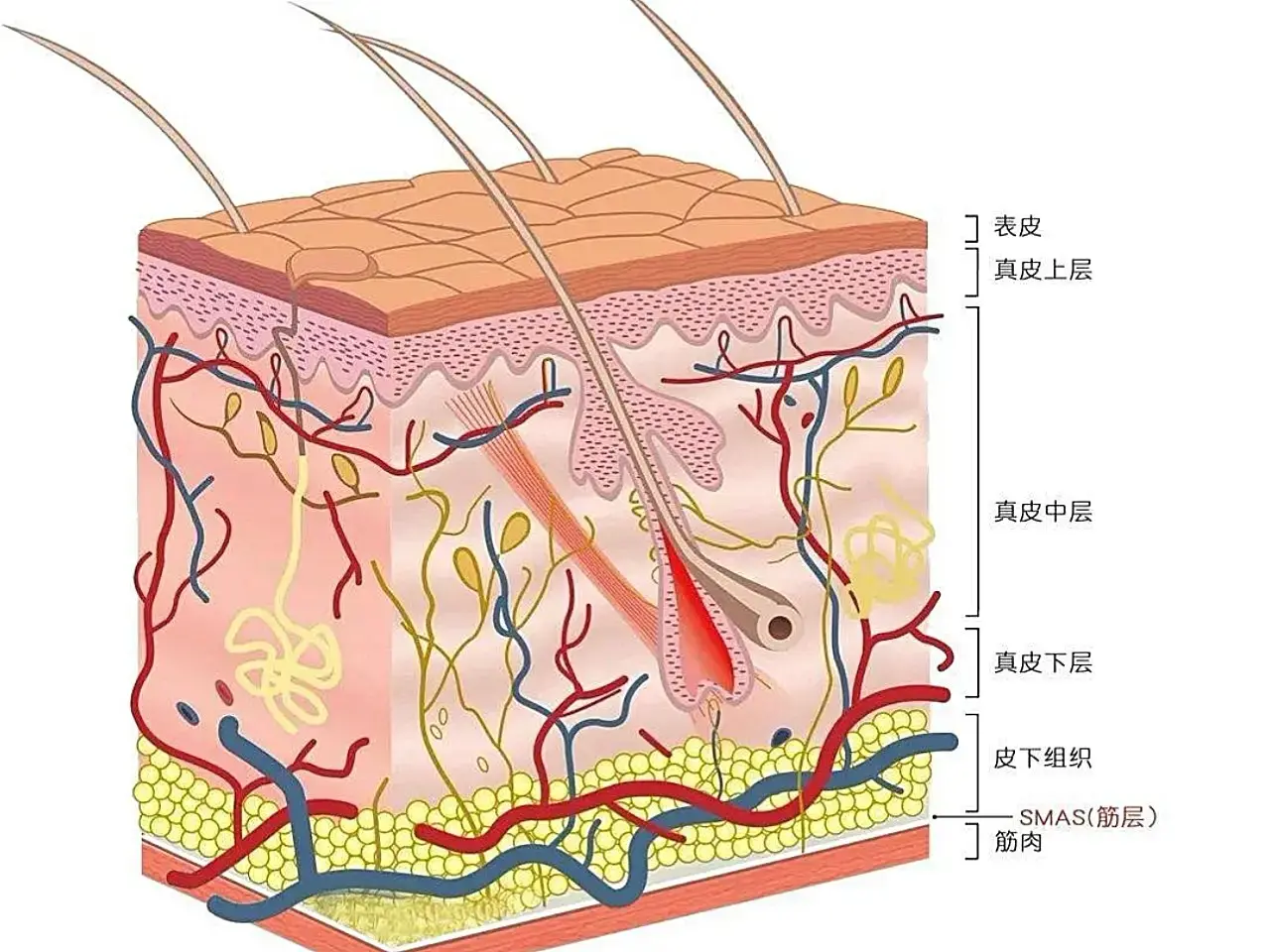 硬核科普關於蹠疣你想了解的都在這裡