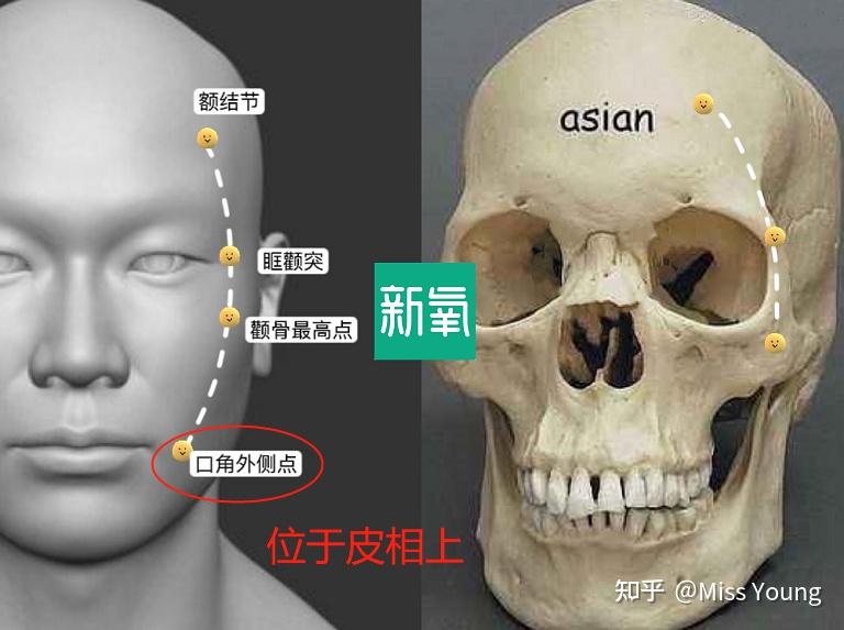 决定内轮廓的四个点:额结节,眶颧突,颧骨最高点,口角外侧点.