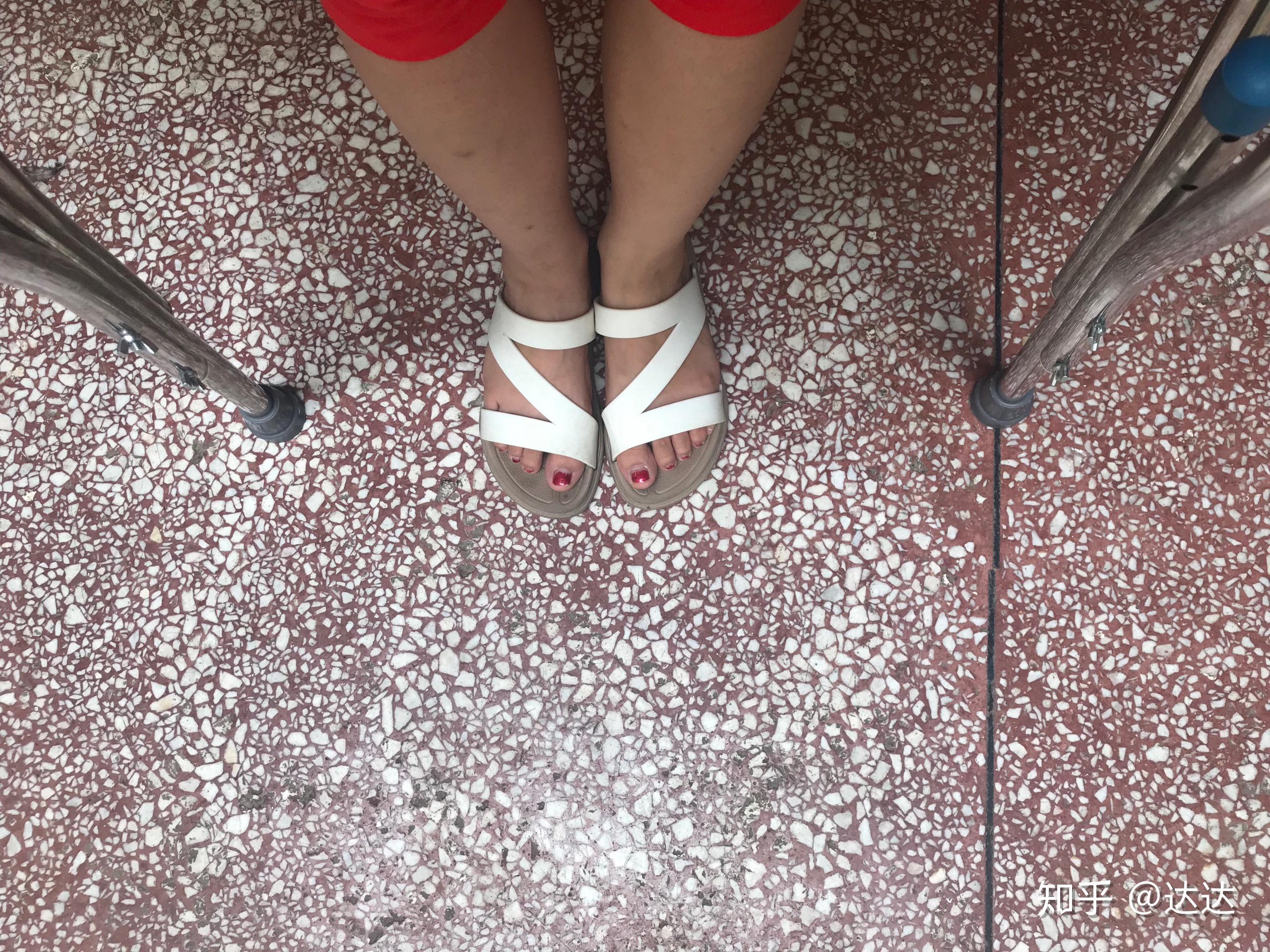 脚踝扭伤全记录 - 知乎