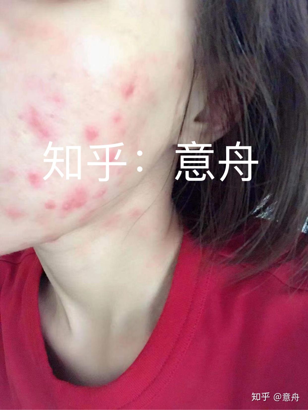 v2-0d379b55e0db9c6b6a8c23314f365f9f_r.jpg