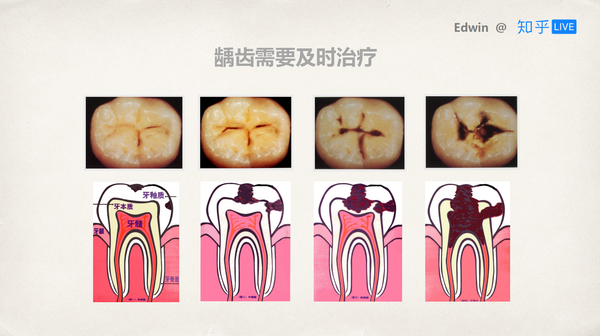 如何从小到大保护好牙齿?
