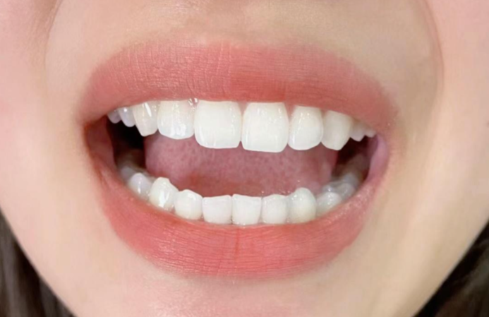 【医学硕士】真实分享,真正科学有效的牙齿美白方法