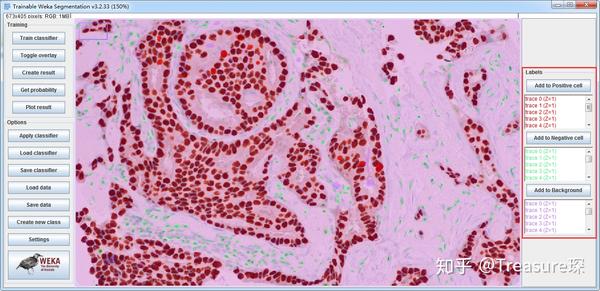 imagej实用技巧免疫组化分析定量分析篇