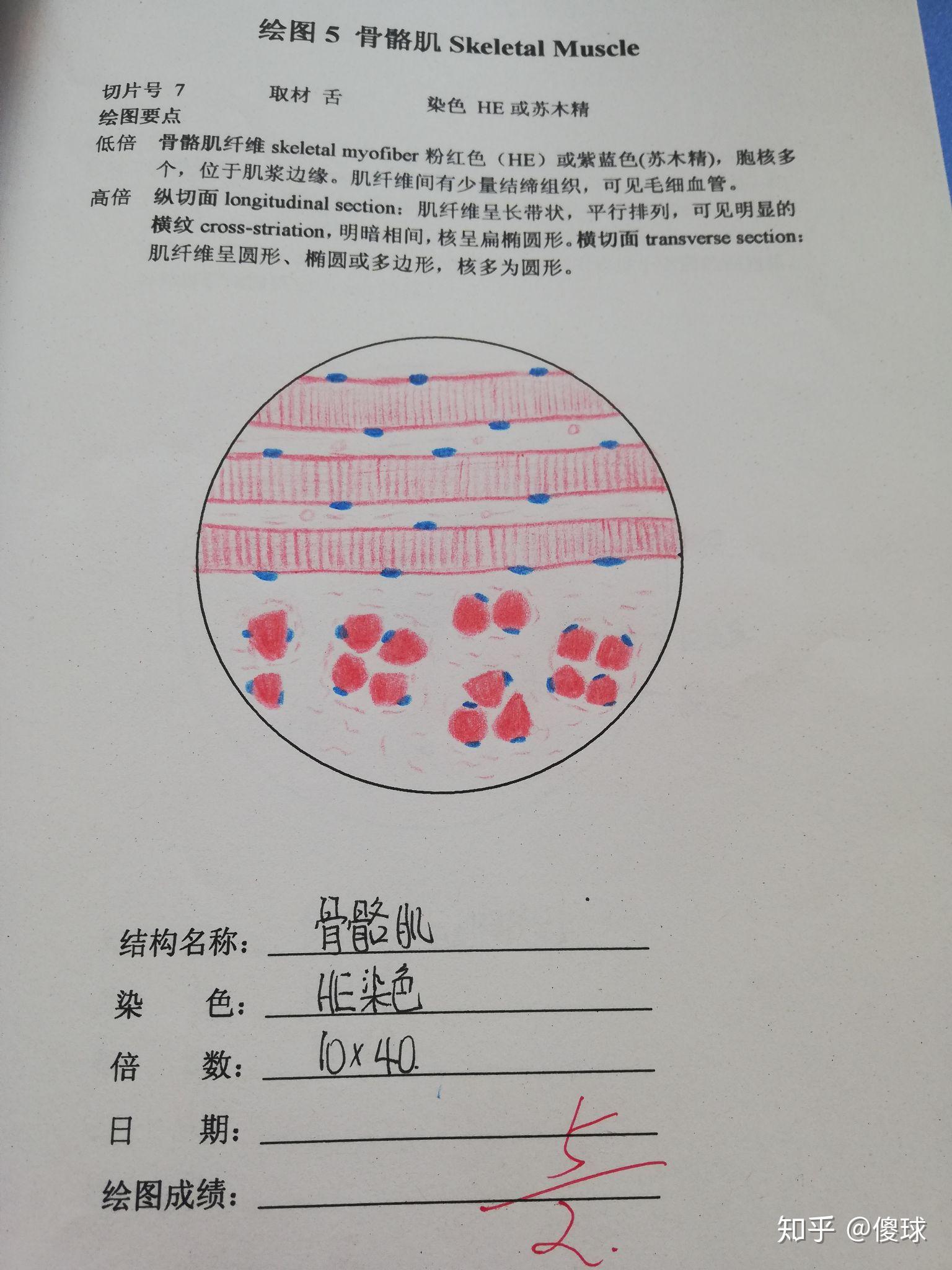 骨骼肌实验报告手绘图图片