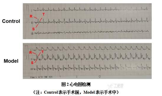 心肌缺血再灌注模型