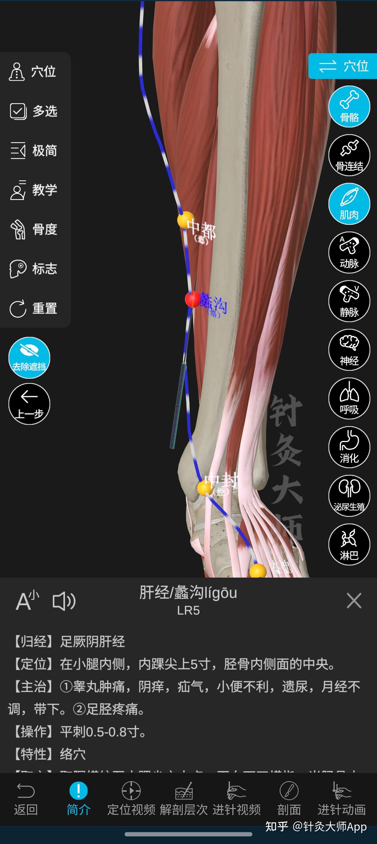 知道周围结构后,再也不怕扎错位置了! - 知乎