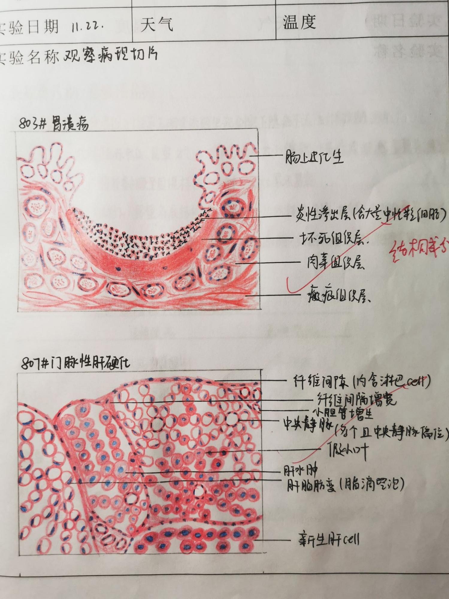 胃切片红蓝铅笔手绘图图片