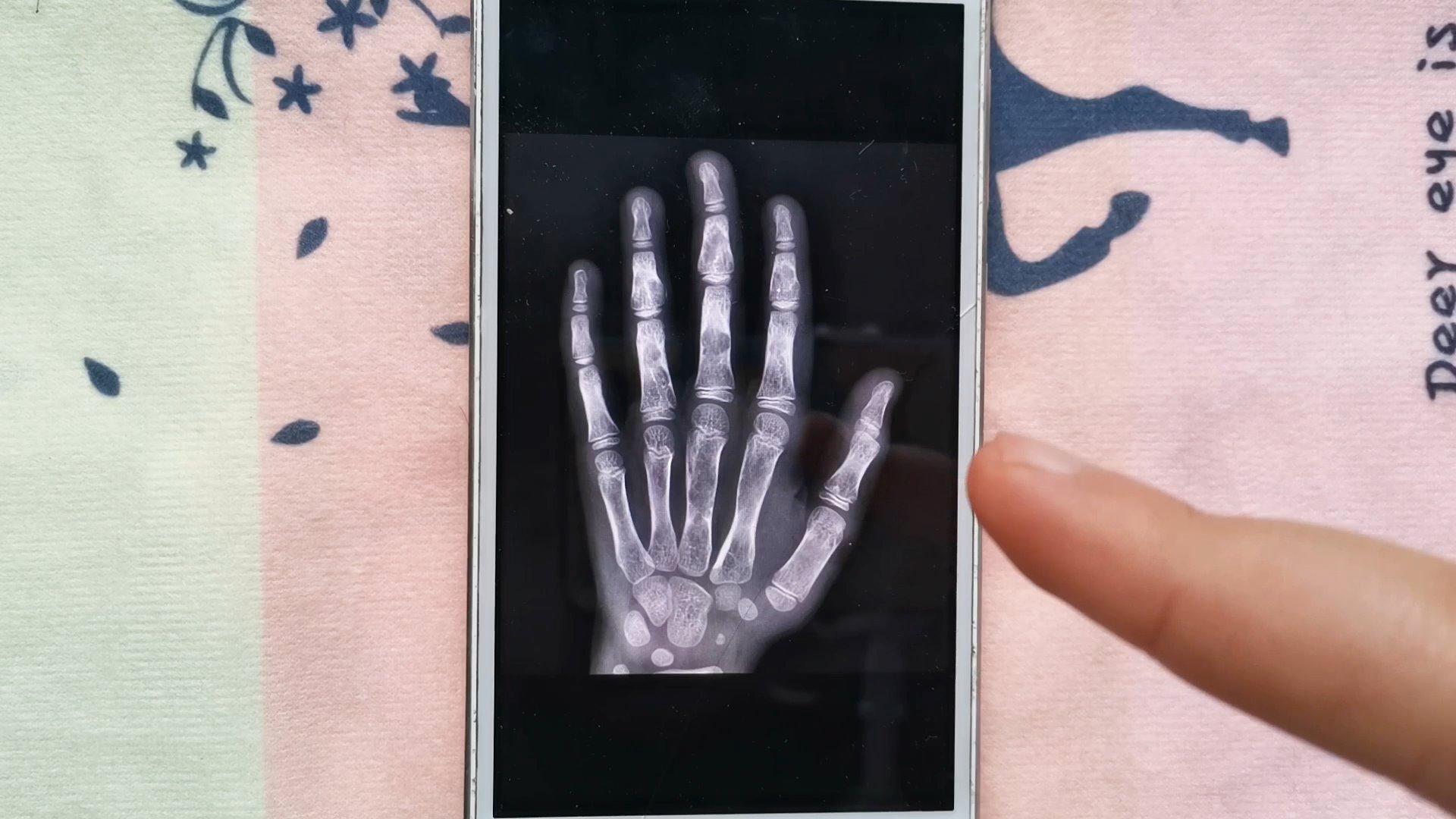 打开手机这透视功能,连老公手掌骨头都可以看到!太神奇了