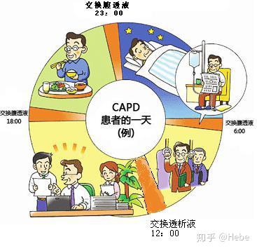 杰瑞自动腹膜透析机为肾病患者健康治疗保驾护航 - 知乎