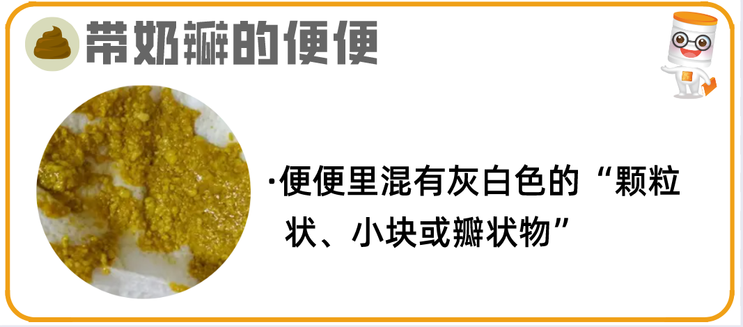 逾20种宝宝大便图片详解!最后10种必须警惕! - 知乎