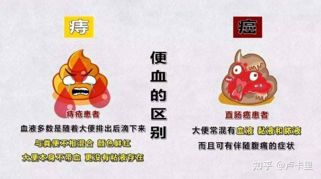 便血需要重视吗? - 知乎