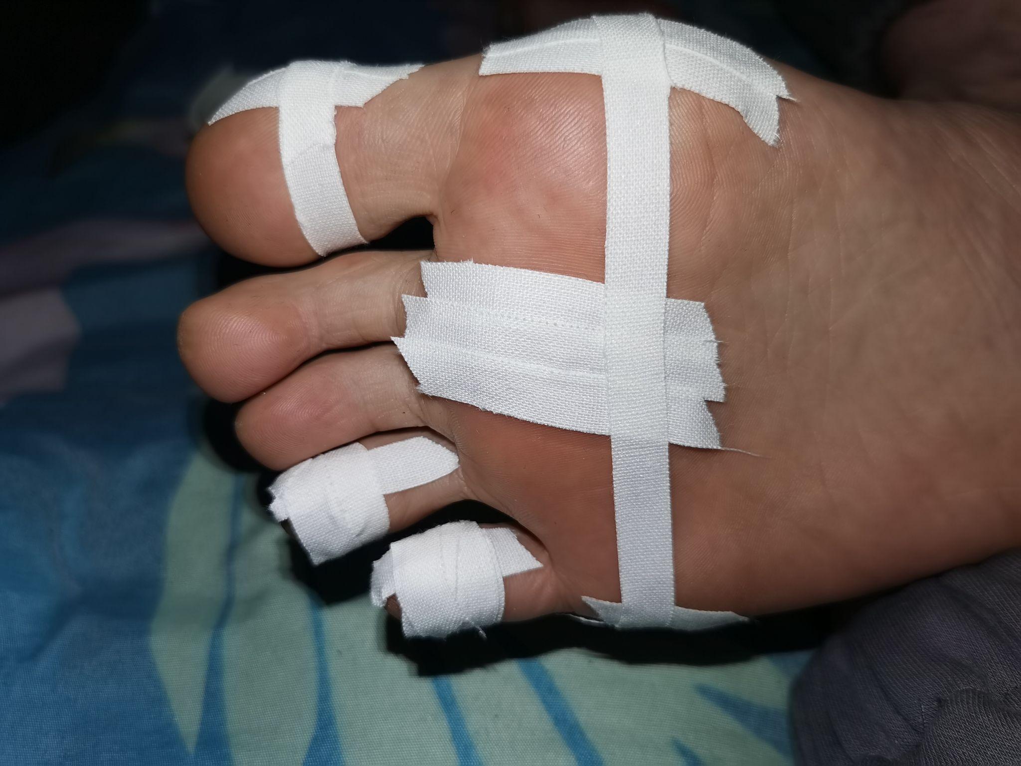 你觉得哪种粘的更牢靠呢到现在的胶带试过双层袜现在脚掌也有茧子然后